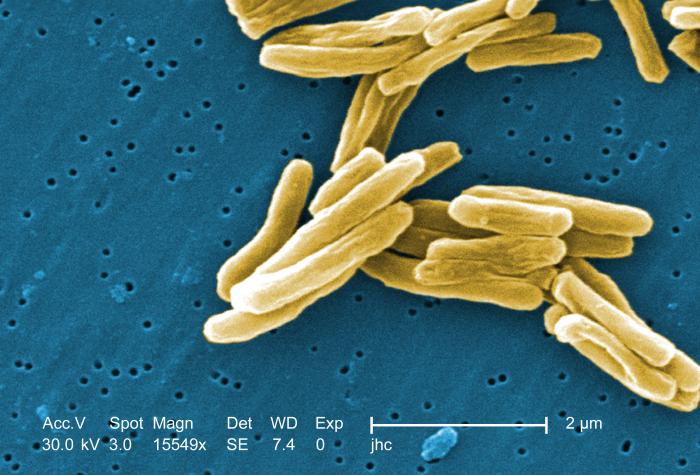 Scanning electron micrograh of TB bacterium/ image: CDC/Dr. Ray Butler, credit: Janice Haney Carr