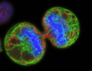 B0003294 Human melanoma cell dividing